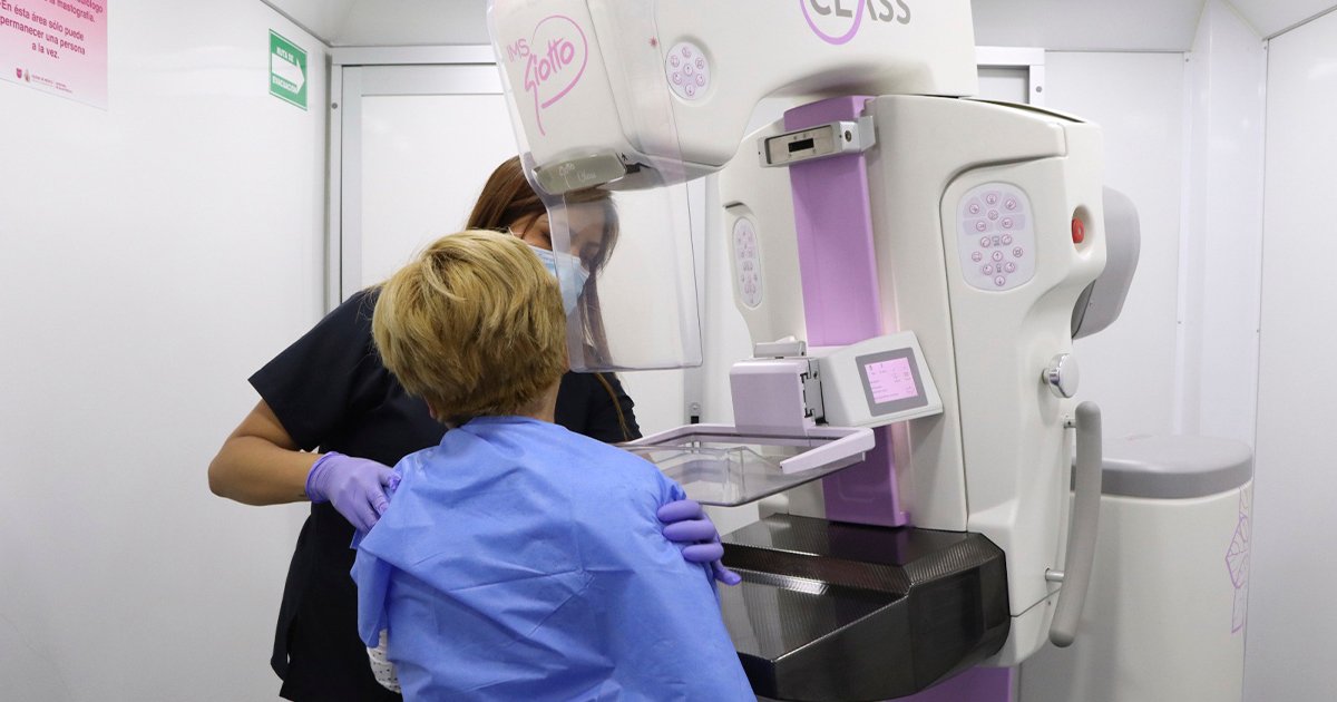 CDMX realiza 100 mil mastografías para detectar cáncer de mama